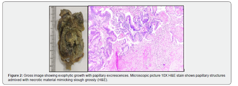 Click here to view Large Figure 2