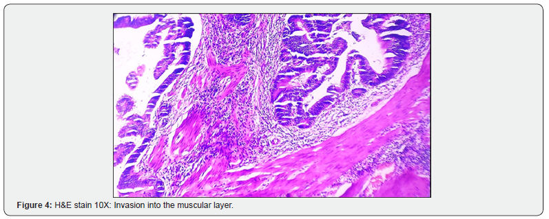 Click here to view Large Figure 4