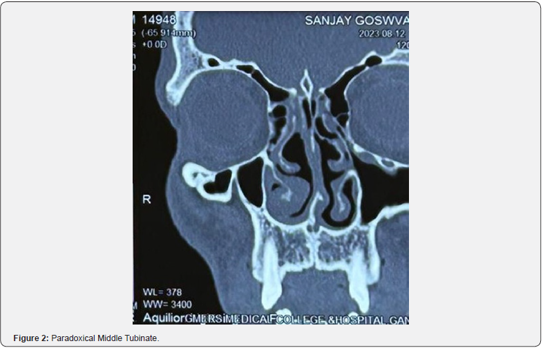 Click here to view Large Figure 2