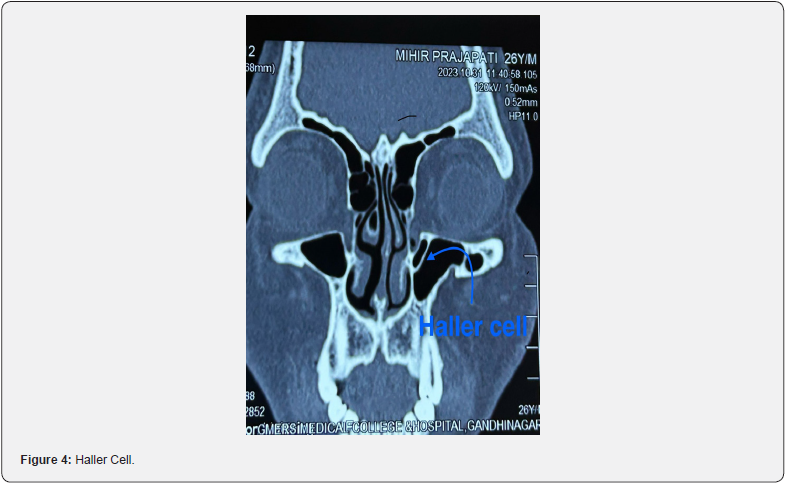 Click here to view Large Figure 4