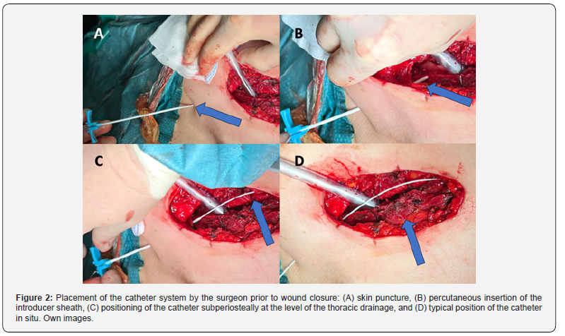 Click here to view Large Figure 2