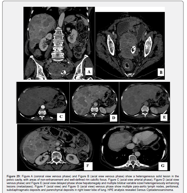 Click here to view Large Figure 29