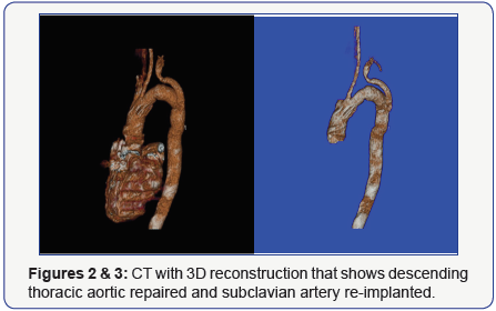 Click here to view Large Figure 2&3